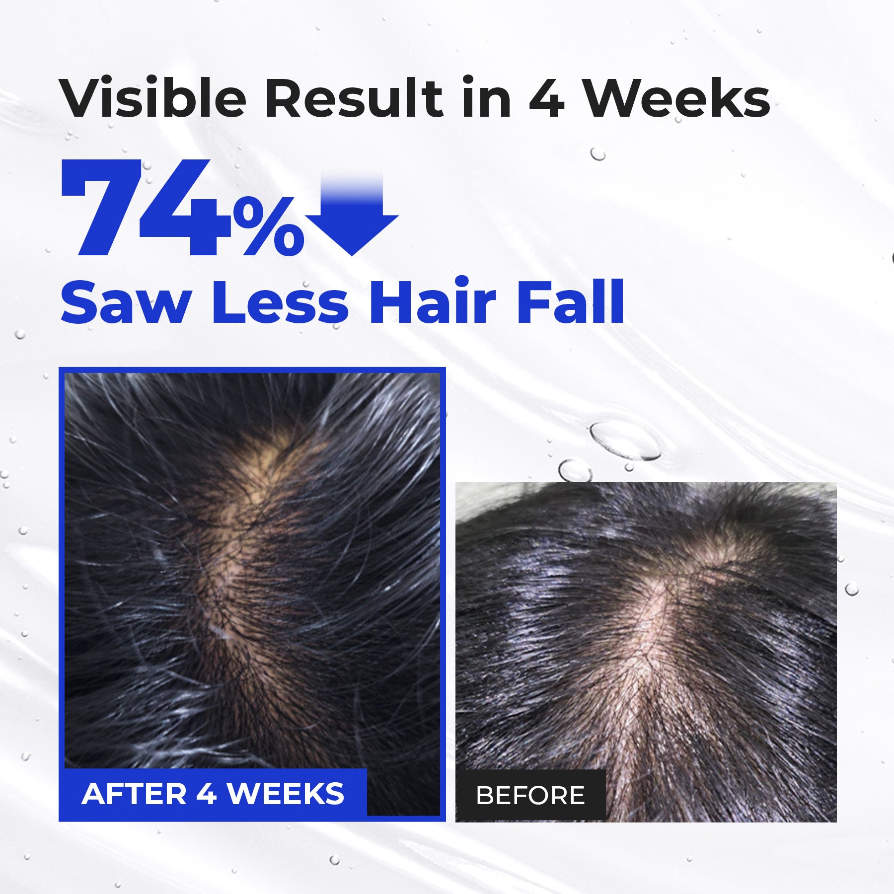 Epais Scalp Boosting Ampoule