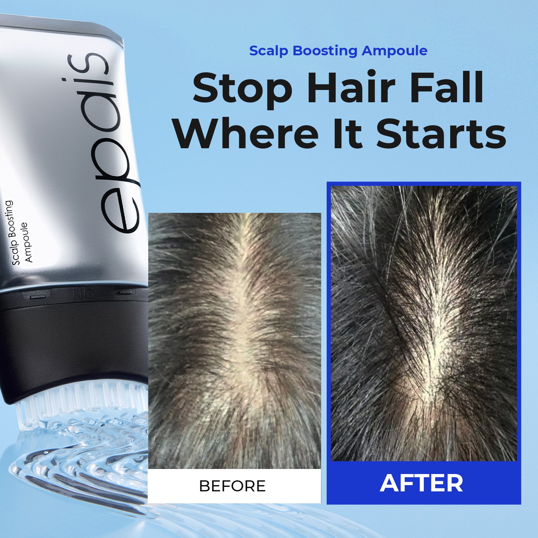 Epais Scalp Boosting Ampoule