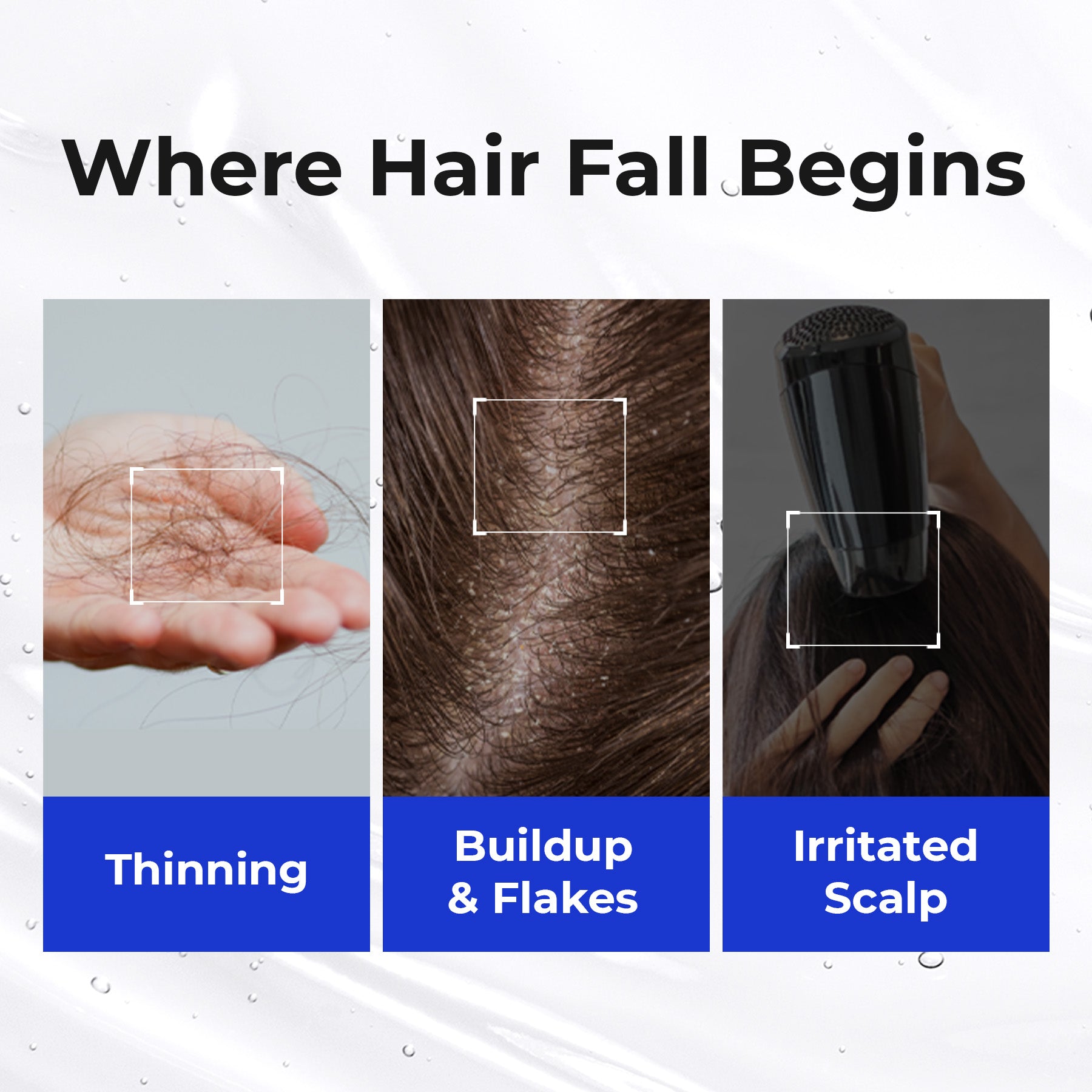 [Amazon] Korea #1 Scalp Boosting Ampoule
