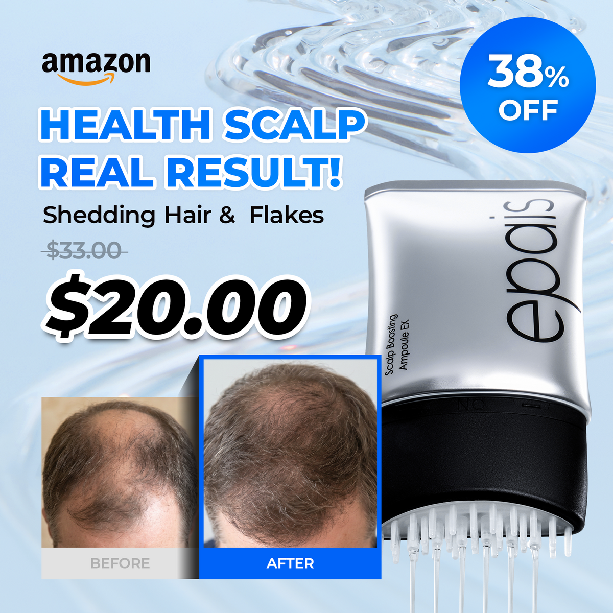 [Amazon] Scalp Boosting Hair Serum