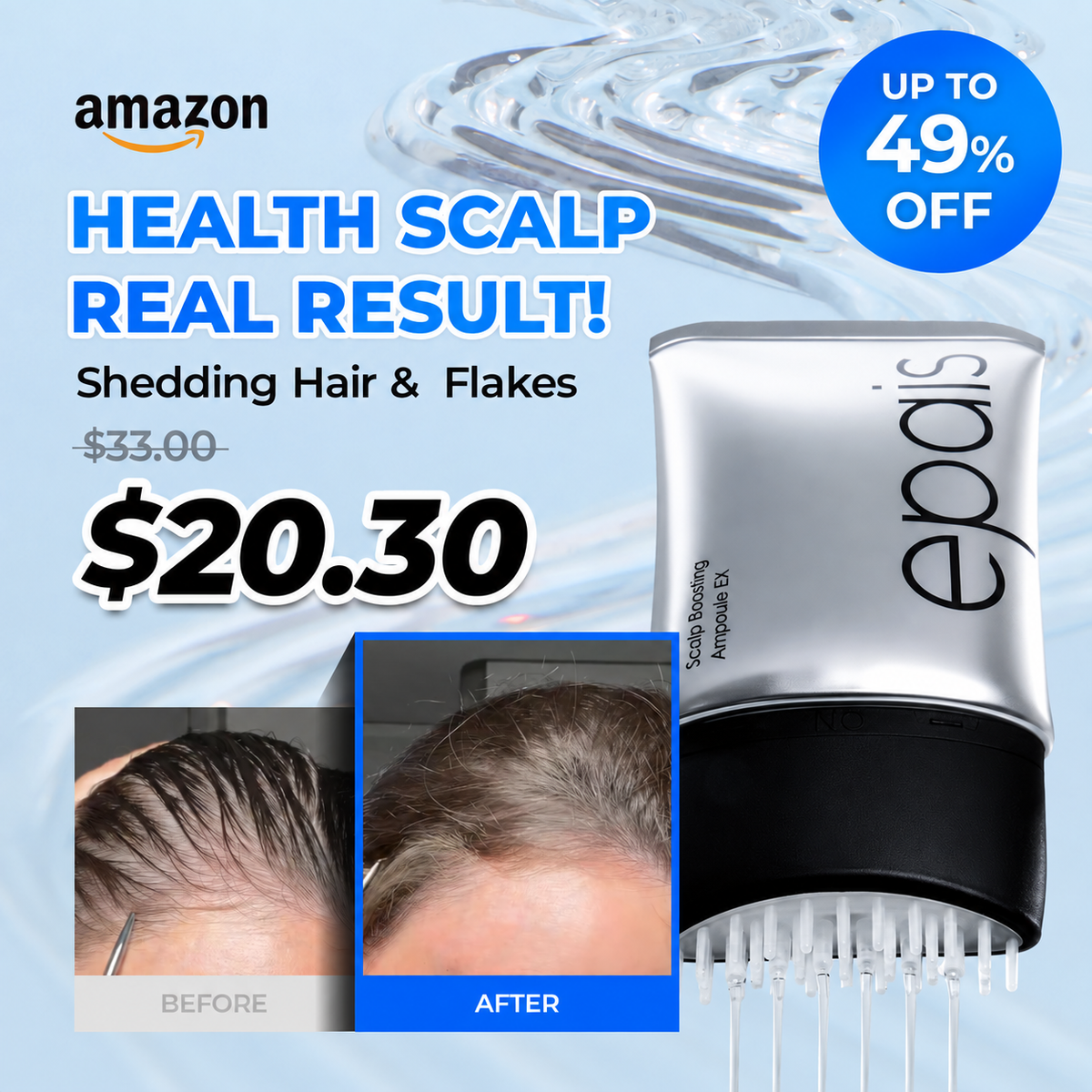 [Amazon] Scalp Boosting Hair Serum