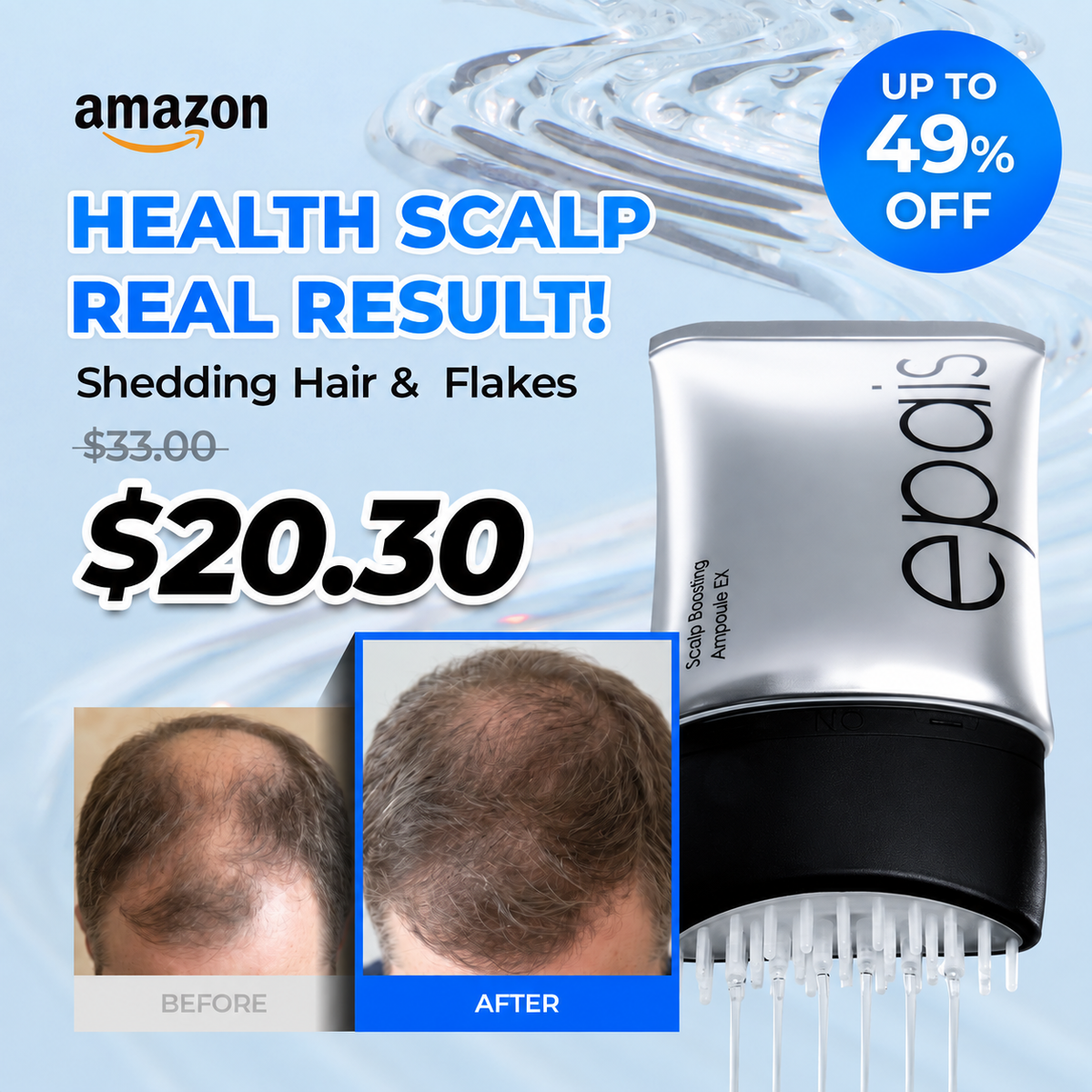 [Amazon] Scalp Boosting Hair Serum